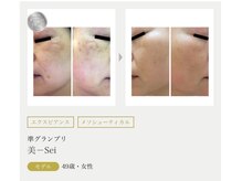 まりも化粧品店/ホワイトスノーピール