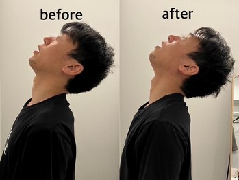 ヴィセラ(Vicella)/ストーレートネック