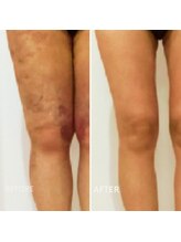 ヒーリングサプリ(Healing Supple)/整形 術後の回復ケア