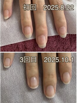 爪育成ハンドネイルケア