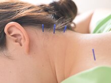 ハートフル鍼灸院/鍼灸