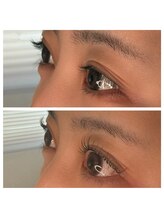 アンバー(Amber)/とにかくぱっちり目を大きく