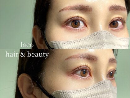 ラーソ(laco)の写真