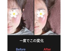 美容矯正サロン レレポノ(LELEPONO)/