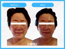 トウメイコガオ 横浜店/トウメイコガオ