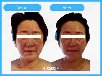 トウメイコガオ 横浜店/トウメイコガオ