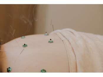 フュー(few.)の写真/つらい首肩こりを諦めないで！女性鍼灸師による丁寧な施術で、根本からの軽やかさを実感◎