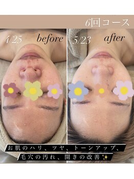 フェリチタ(felicita)/驚きの変化！ハーブピーリング♪