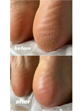 ビンナ 五反田店(Binna)/足裏角質ケア