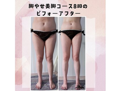 アイナ(aina)の写真