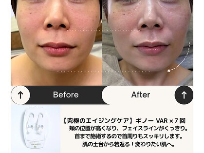 ルームエイトエイティスリー 新宿(R883)の写真