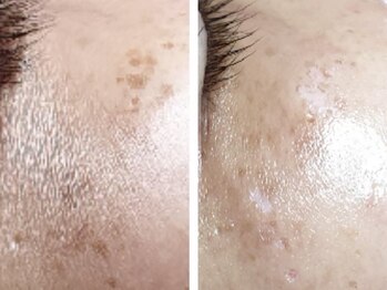 チャーム 草津東口店(Charm)/【ララピール】