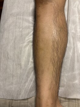 メンズブリリアンス/角質もとれツルスベ肌に★