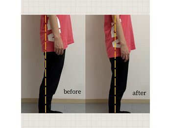 トゥルーミー(True Me)/前ももの張り気になりませんか?