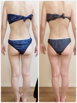 リナル 祐天寺店/120分☆痩身マシン＋全身リンパ