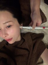 ハチハチ(808)/ソフトダーマ