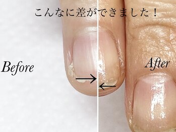 トゥインクリーネイルサロン(Twinkly Nail Salon)/【地爪育成】1回お試し