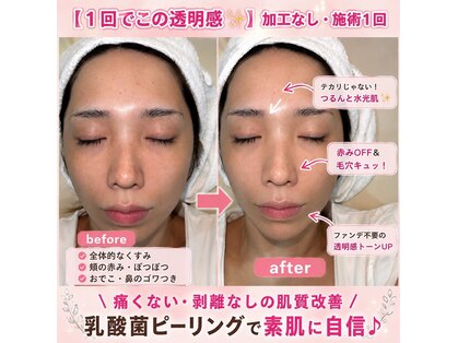 リミープラス 豊中曽根店(Re:Me+)の写真