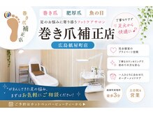 巻き爪補正店 広島紙屋町店