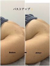 メディカルサロンドオフ 堺東店(medical salon de off)/光バストアップメニュー♪前後