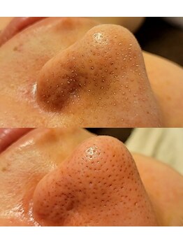 サロンドリー(salon de Re)/超音波エクストラクション