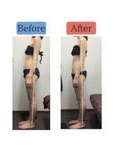 ステイゴールド美容整体院(STAY GOLD)/横からみた立ち姿の改善方法