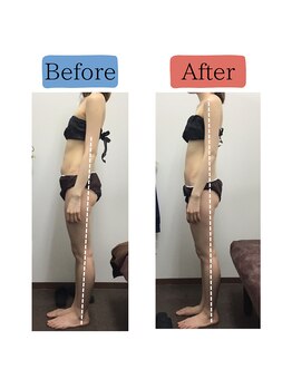 ステイゴールド美容整体院(STAY GOLD)/横からみた立ち姿の改善方法