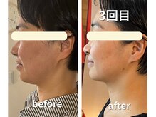 カルナー 武蔵小杉/3回目のフェイスラインをキープ