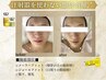 【別人級小顔！】脂肪分解レモンボトル注入2cc＆美整顔３Ｄ小顔♪