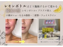 グロッシー(glossy)