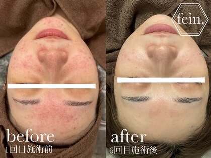 フェイン 青山店(fein.)の写真