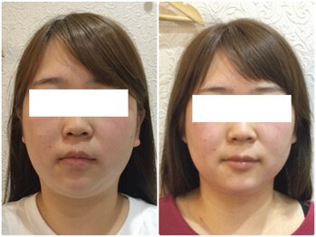 美容整体 ウェリナ 蟹江院/小顔矯正/骨盤矯正/美脚サロン