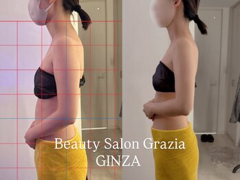 グラツィア 銀座(Grazia)/1回【 ブライダルエステ整体 】