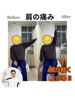 三条かがやき整体院/肩の痛み改善