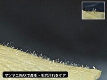 シエスタ 新小岩の雰囲気（毛穴の黒ずみ・詰まりをすっきり♪マツヤニホットセラピー）