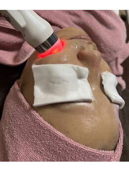 サロン エムイー(Salon ME)/毛穴&小顔