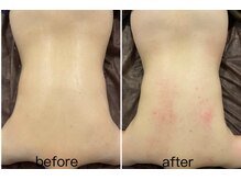 ラインビューティ 上野 御徒町(LINE BEAUTY)/正規取扱ハイパーナイフ