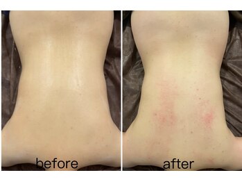 ラインビューティ 上野 御徒町(LINE BEAUTY)/正規取扱ハイパーナイフ