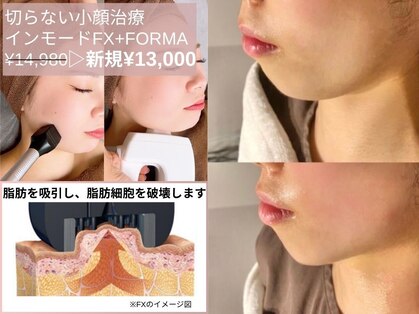 ルディラ 新宿店の写真