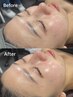 8・9月限定☆艶肌韓国美容♪SNSで話題の【ララピールお試し】13,200→6,980
