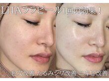 エムラボ 渋谷店(M LABO)/LHAララピール