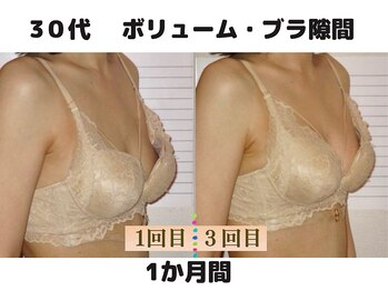 バストサロン メルベイユ(Merveile)/ブラ隙間軽減でふっくらバスト
