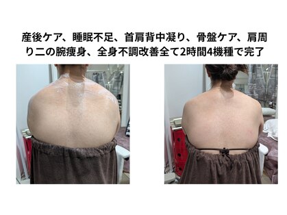 スキャニング@ラボエステの写真