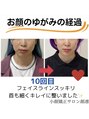 顔凛(カオリン)&nbsp;お顔の歪み改善お任せください。小顔矯正/小顔