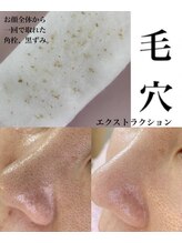 トトサロン(toto salon)/何してもダメな肌のザラツキ