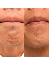 アヴィジョン(Avision)/