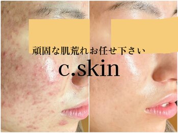 シースキン 盛岡駅前店(c.skin)