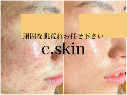 シースキン 盛岡駅前店(c.skin)の写真