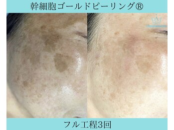 リメイククリニカルビューティー(Remake clinical beauty)/何をしても改善さしなかった