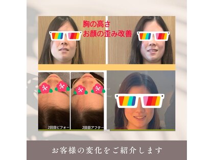 ルクシア(Luxia)の写真